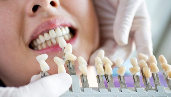 A Guide To Know About The Advantages Of Take-Home Teeth Whitening